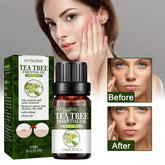 Pure Tea Tree Oil