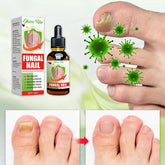 Nail Fungus Treatment Solution