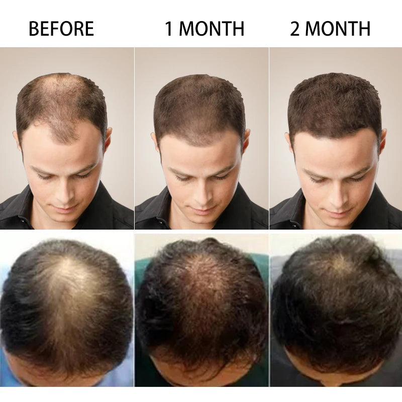 PURC Hair Growth Oil